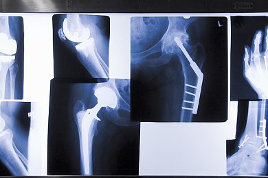 总裁尿急在车里被揉失禁｜紧急避难：总裁车事隐私挑战