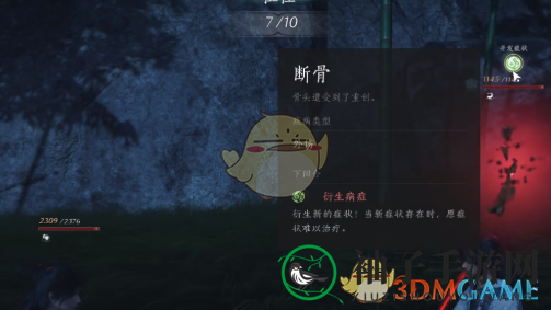 《燕云十六声》骨折处理方法
